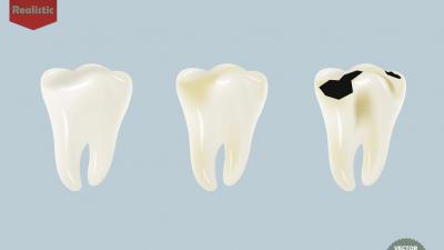口腔工藝技術專業