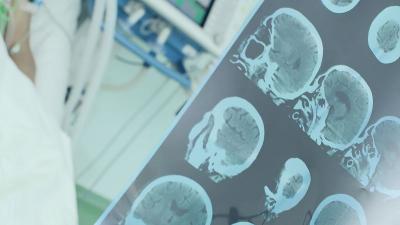 醫(yī)學影像技術(shù)專業(yè)